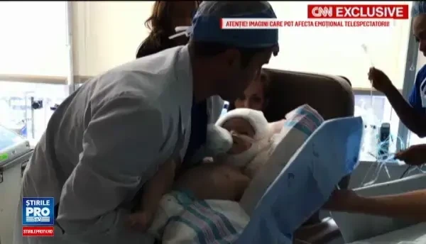 Momentul emotionant in care doi gemeni care s-au nascut lipiti in zona capului se privesc in ochi pentru prima data. FOTO