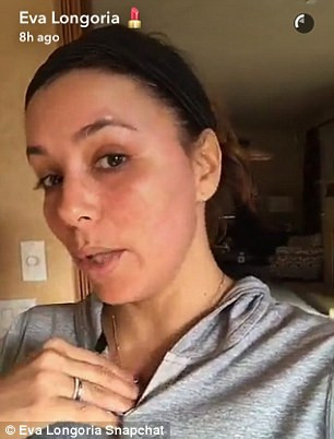 Fotografia care i-a ingrijorat pe fanii actritei Eva Longoria. Ce a patit vedeta la fata. VIDEO