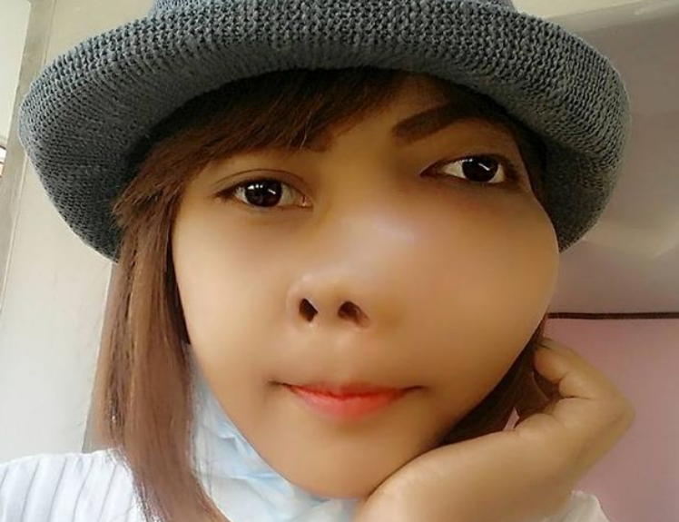 S-a dus la dentist pentru o durere de masea, dar a aflat ca are cancer. Tanara, acuzata ca a modificat pozele ca sa arate asa