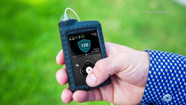 Pancreasul artificial va fi lansat pe piata anul viitor. Cum le va schimba viata bolnavilor de diabet