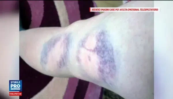 Profesoara batuta de un elev de 12 ani, in Vaslui, a intrat in concediu medical. Politia si scoala au inceput anchete