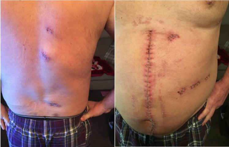 Un barbat de 56 de ani a fost injunghiat de 10 ori, pe strada, iar incidentul a fost filmat. Urmarile atacului