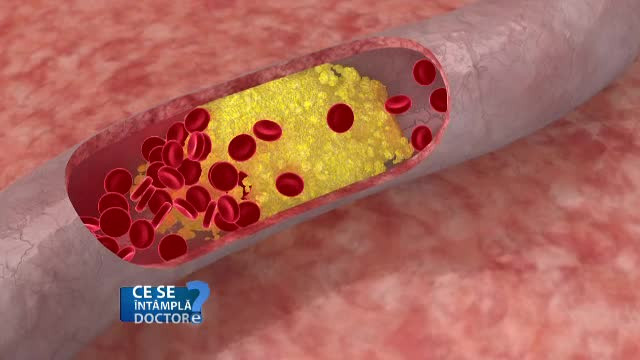 Stresul oxidativ, determinat si de tigara, poate face ravagii in organism. Care este cel mai eficient anti-oxidant