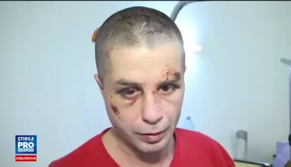 Relatie cu nabadai intre un barbat din Targoviste si fosta sa sefa. Motivul pentru care ar fi fost batut de apropiatii femeii