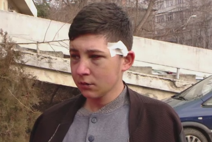 A fost batut crunt la o petrecere de un alt tanar, care l-a lasat intr-o balta de sange. Motivul uluitor al scandalului