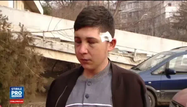 Baiat de 18 ani, din Botosani, batut crunt la o petrecere de un alt tanar. Cearta a inceput de la iubita agresorului
