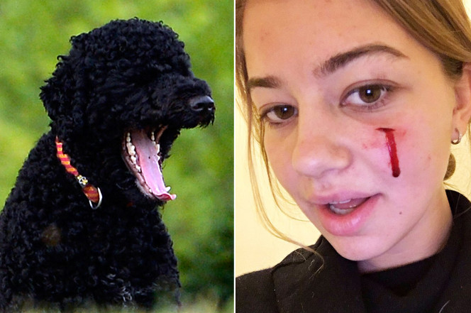 O adolescenta invitata la Casa Alba, muscata de fata de unul dintre cainii familiei Obama. Ar putea ramane cu cicatrice. FOTO