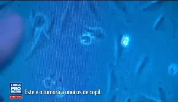 Cum ar putea elefantii sa ajute in lupta contra cancerului. Proteina descoperita de cercetatorii americani