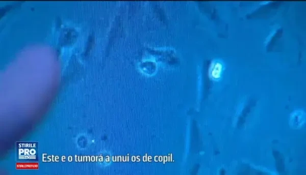 Cum ar putea elefantii sa ajute in lupta contra cancerului. Proteina descoperita de cercetatorii americani