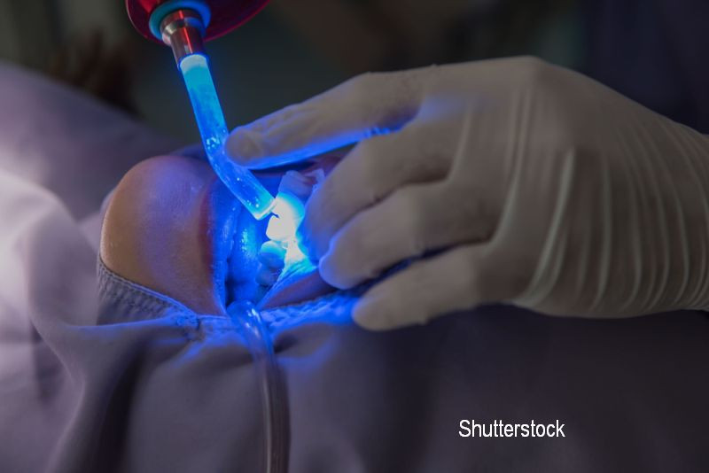 Un rus si-a gravat pe dinti chipurile lui Trump si Putin. Cat l-a costat acest capriciu pe barbatul excentric. FOTO