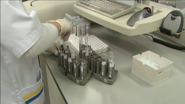 Romania, pe locul 4 in Europa la numarul de decese din cauza hepatitei. Situatia delicata a copiilor nascuti anul acesta