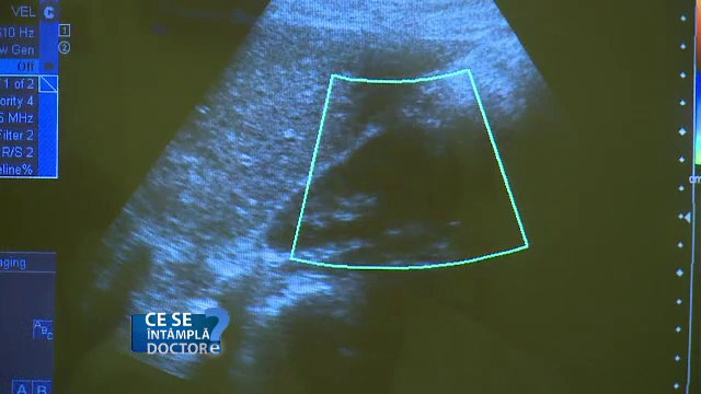 ecografie