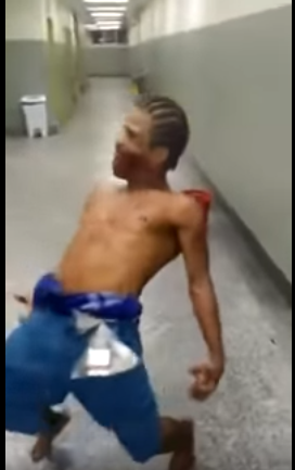 Un barbat impuscat in fata a speriat un spital intreg. Medicii si pacientii au crezut ca era "posedat". VIDEO