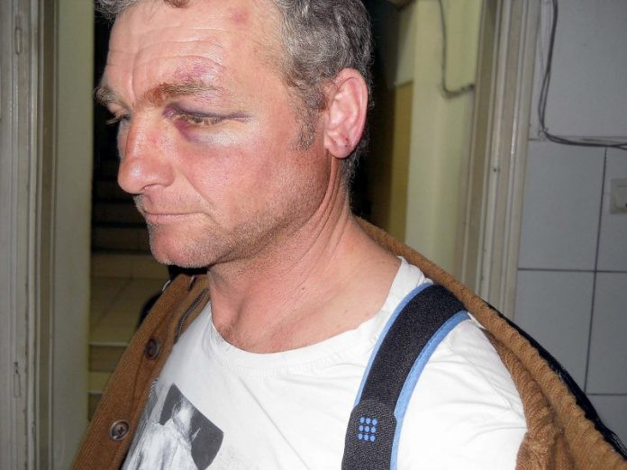 Barbat de 41 de ani din Cluj, batut si lasat cu clavicula rupta de 3 sateni. De ce nu a dorit sa depuna plangere la politie