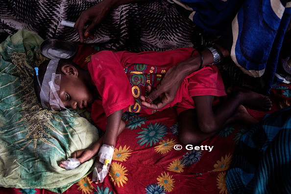 110 oameni au murit in 48 de ore in sudul Somaliei de foamete si diaree, din cauza secetei