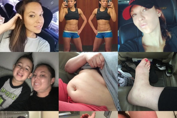 Un model pentru bikini marturiseste ca boala i-a mutilat trupul si ii este teama sa se uite in oglinda: "Am ajuns un monstru"