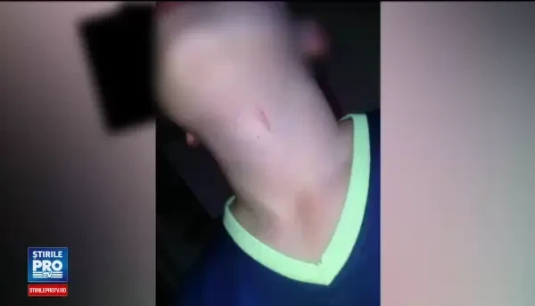 Profesor din Lupeni, fost viceprimar, acuzat ca a batut un elev. Era vanat la gat si la spate