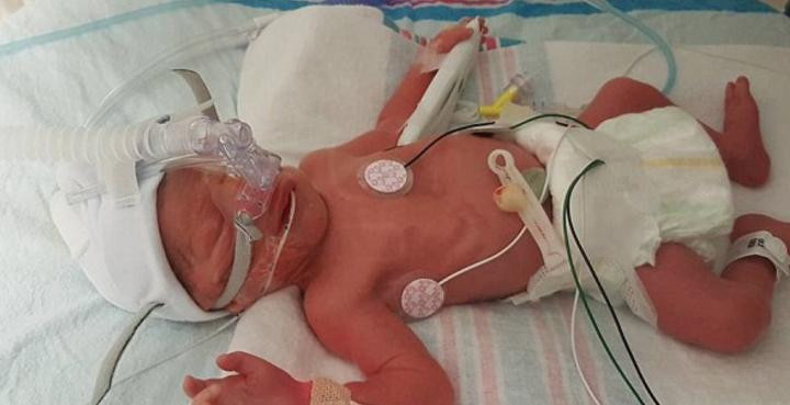 O asistenta a adormit cu un bebelus in brate, l-a scapat pe jos si i-a spart capul. Mama a aflat de situatie la externare