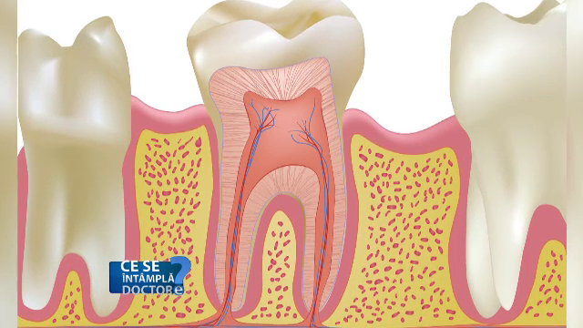 Faceţi orice efort pentru a salva un dinte natural. Nicio tehnică stomatologică nu atinge perfecţiunea acestuia