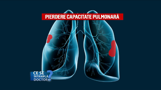 capacitatea pulmonara