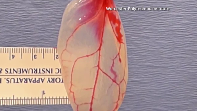 Progresele in medicina intrec orice imaginatie. Cercetatorii au transformat frunze de spanac in tesut cardiac
