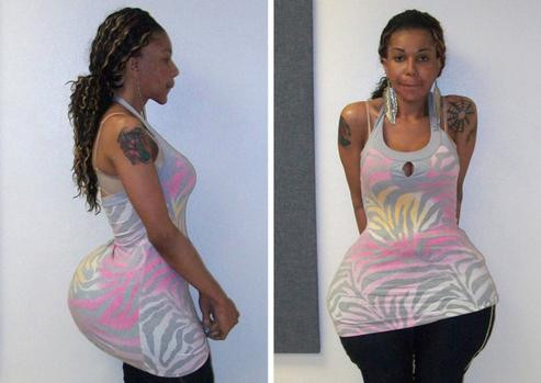 O femeie din SUA a primit 10 ani de inchisoare pentru ca facea implanturi fesiere ucigase. Cu ce isi injecta clientele