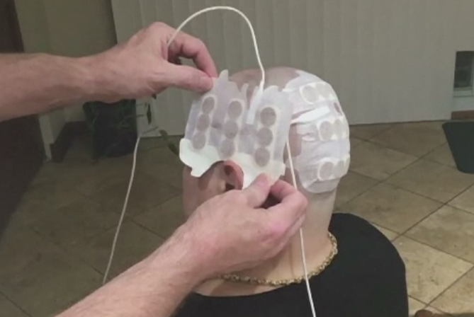 Succes important in medicina. Cercetatorii americani au creat tratamentul care prelungeste viata celor cu tumori pe creier