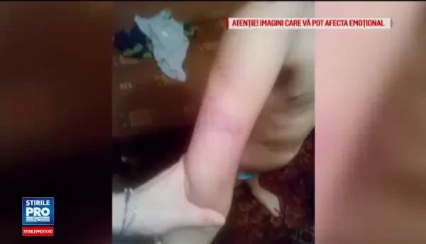 Noi agresiuni in cazul copiilor cu dizabilitati abuzati la scoala ies la iveala. Imaginile facute publice de mama unui elev