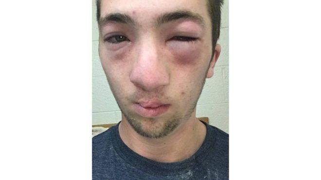 Un student din America i-a pus colegului sau unt de arahide pe fata. De ce risca o pedeapsa de trei luni de inchisoare