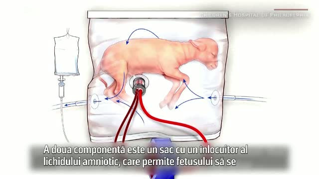 Inca o frontiera a stiintei a fost depasita. Cum functioneaza "uterul artificial" conceput pentru bebelusii nascuti prematur
