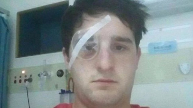 Un fotbalist si-a dat in judecata fostul club fiindca si-a pierdut vederea. Cu ce a aruncat in el un oficial. FOTO