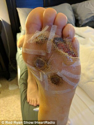 picior infectat