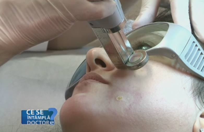 V-ati taiat pe o portiune expusa a pielii? Motivul pentru care nu trebuie sa o lasati sa se vindece de la sine