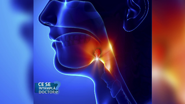 Cele doua situatii in care medicii recomanda scoaterea amigdalelor. Importanta lor pentru sistemul imunitar