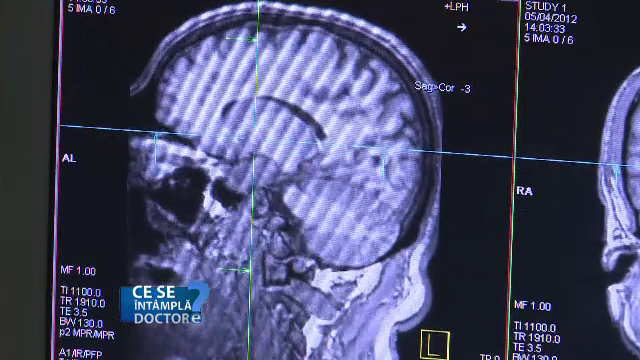 De ce trebuie sa faceti pauza atunci cand sunteti stresati. Aceasta stare va poate afecta sistemul imunitar si organele