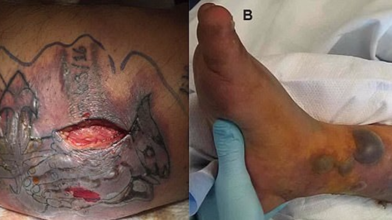 Un barbat a murit la putin timp dupa ce si-a facut un tatuaj! Sfatul pe care l-a ignorat