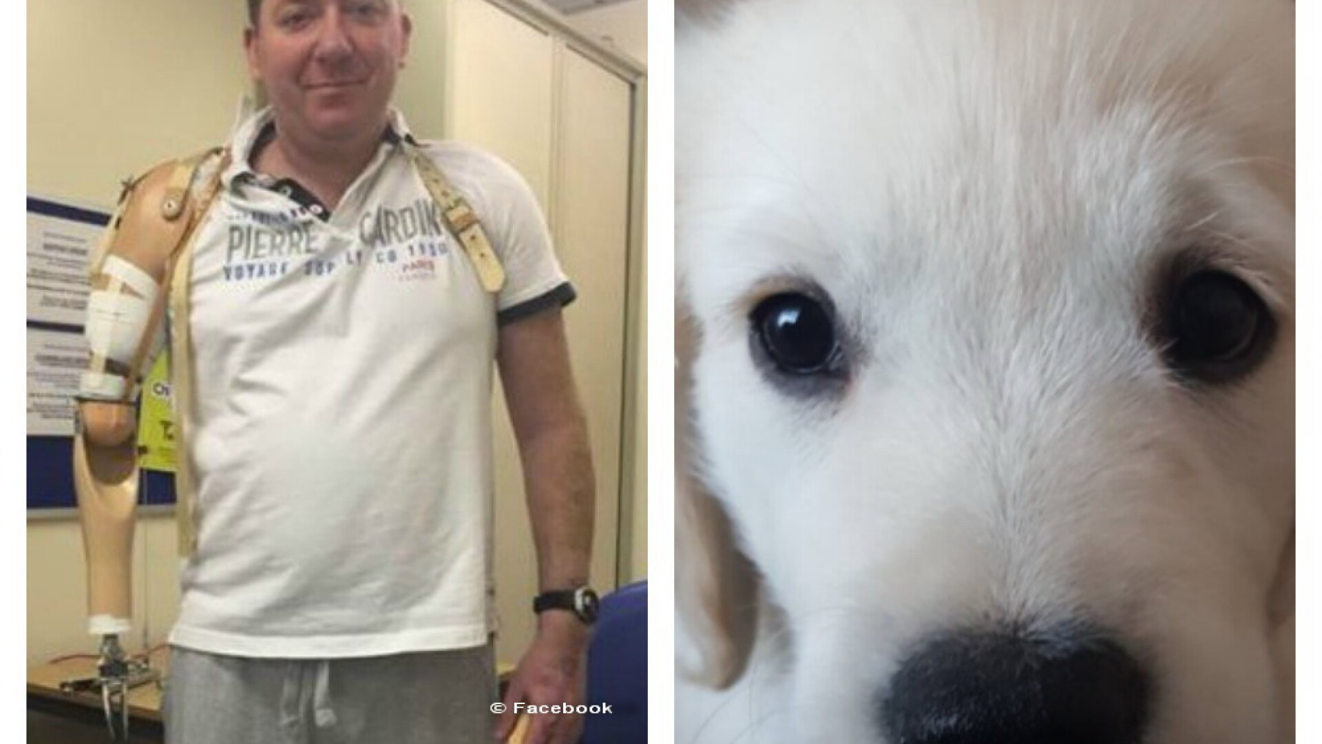 Muscatura aparent inofensiva a catelusului sau l-a lasat fara un brat. Drama traita de un barbat dupa un incident banal