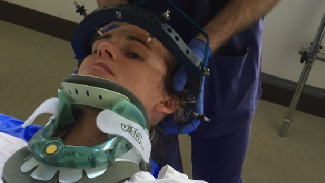 O femeie si-a fracturat gatul dupa ce a stranutat. Ce s-a intamplat la o diferenta de 5 ani, dupa ce a ras. FOTO