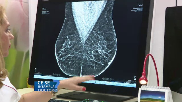 Specialistii recomanda macar un screening si o mamografie pe an, dupa 40 de ani. Evenimentul care va avea loc pe 10 iunie