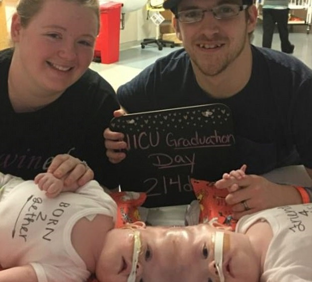 Prima aniversare, cu totul speciala pentru gemenele americane, care au primit cadou o sansa la viata. Cum a decurs operatia