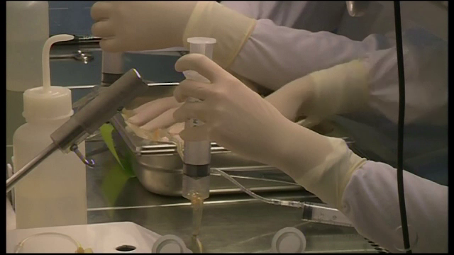 Grasimea de pe burta sau de pe solduri ne-ar putea salva viata. Procedurile folosite de medicii din Japonia