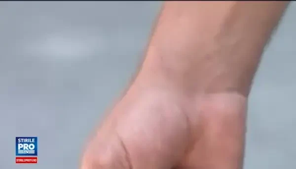 Doi tineri din Craiova sustin ca au fost batuti de politistii rutieri. Acestia nu ar fi oprit la semnalul agentilor