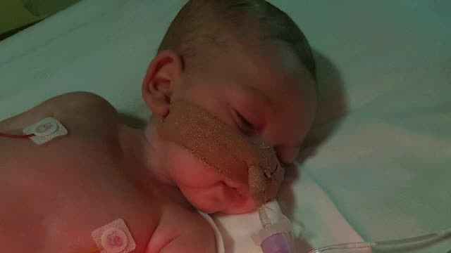 Campania pentru salvarea bebelusului Charlie are succes. Tribunalul ar putea retrage decizia de deconectare de la aparate