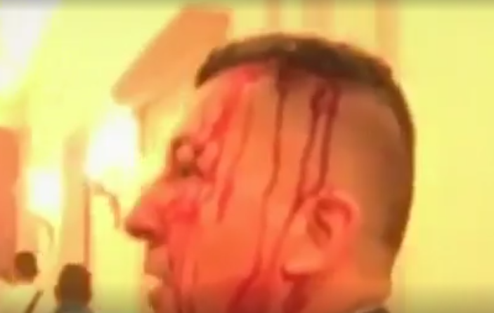 Parlamentul venezuelean, sub asediul sustinatorilor presedintelui Maduro. Trei deputati plini de sange. VIDEO