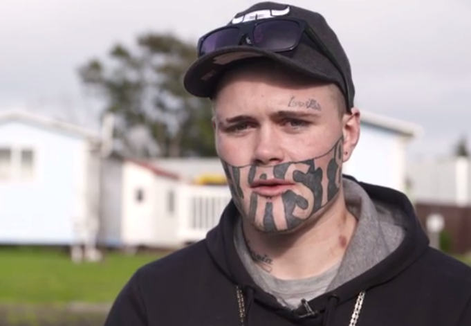 Este devastat ca nu isi poate gasi un loc de munca din cauza tatuajului de pe fata. Cum s-a ales tanarul cu el