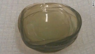 Medicii britanici i-au gasit unei femei intr-un ochi 27 de lentile de contact: "Am fost socati. N-am mai intalnit asa ceva"