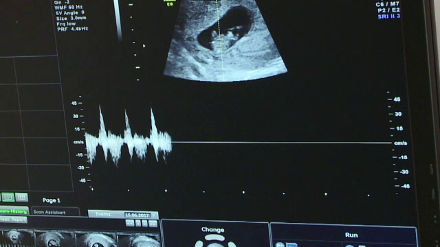 Cum ar putea statul sa le ajute pe romancele care apeleaza la fertilizarea in vitro. Cuplurile ajung sa faca credite bancare