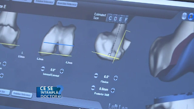 Riscul la care va expuneti daca va doare genunchiul mai mult de doua saptamani si nu ii faceti o radiografie