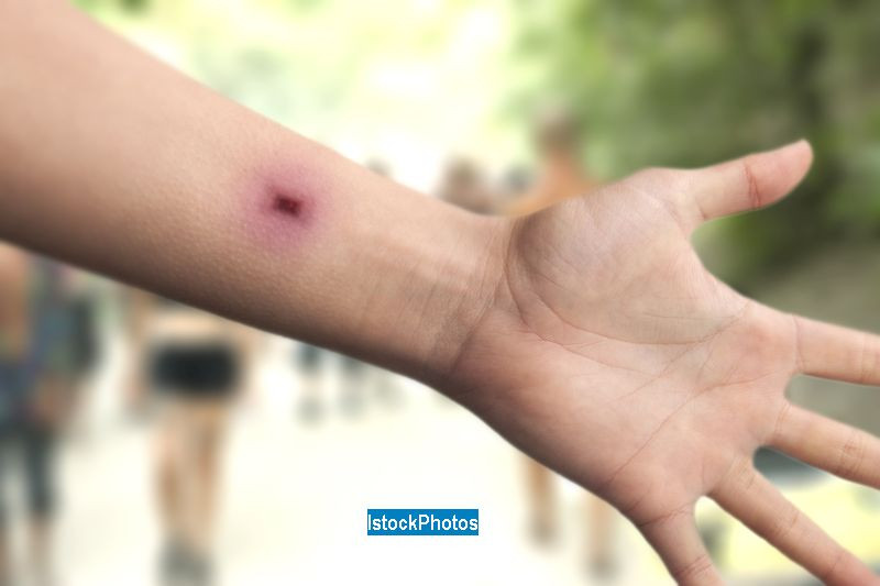 O companie americana a decis sa implanteze microcipuri angajatilor sai