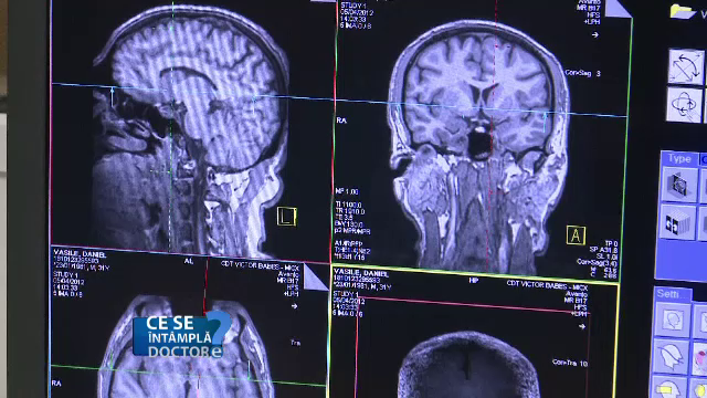 Cat de periculoase sunt, de fapt, rinitele alergice. La copii poate conduce si la modificari fizice inestetice